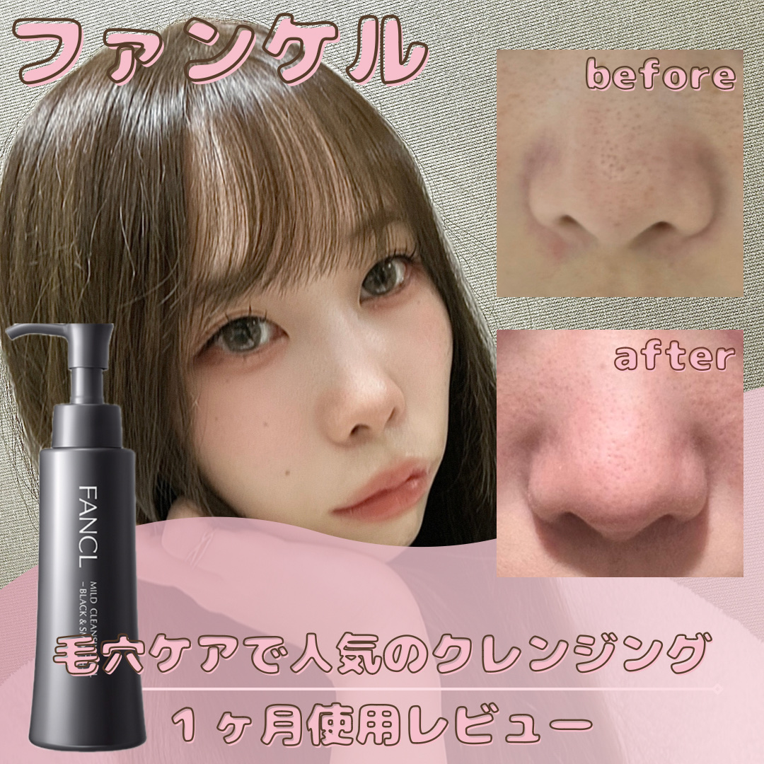 ソフティモ ホワイト クレンジングオイル 本体 240ml/ソフティモ/オイルクレンジングを使ったクチコミ（1枚目）