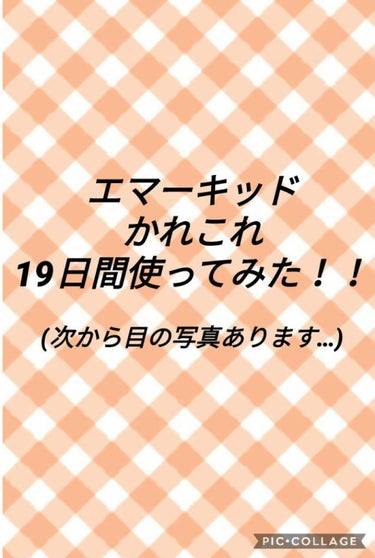 🌼エマーキッド使いはじめて19日経ちました❗🌼

使いはじめて1週間ごとに投稿したかったんですが中々できず
すみません💦

結果的には伸びてきました❗❗😲
ただ、こればかりは個人差なのか下まつげよく伸び