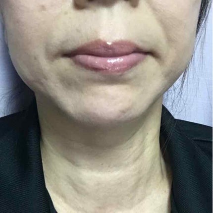 ブルーミングオイルグロス/KiSS/リップグロスを使ったクチコミ(3枚目)