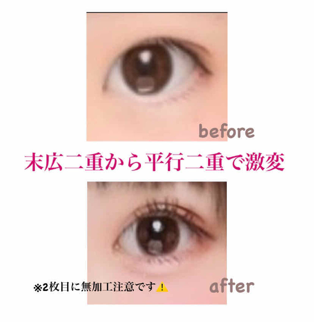 のびーるアイテープ（絆創膏タイプ、レギュラー）/DAISO/二重まぶた用アイテムを使ったクチコミ（1枚目）