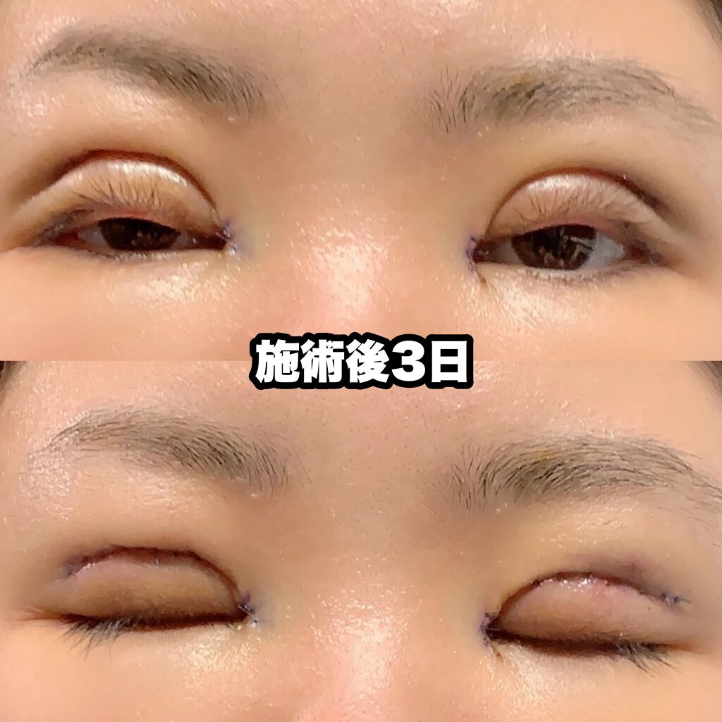 ïŸïœïœ³âžð·ïžâžâ on LIPS ãããã«ã¡ã¯ïŸïœïœ³ã§ãâžð·ïžâžâå
æ¥äºéæŽåœ¢ãããŸããïŒä»åã¯ç§..ãïŒ5æç®ïŒ