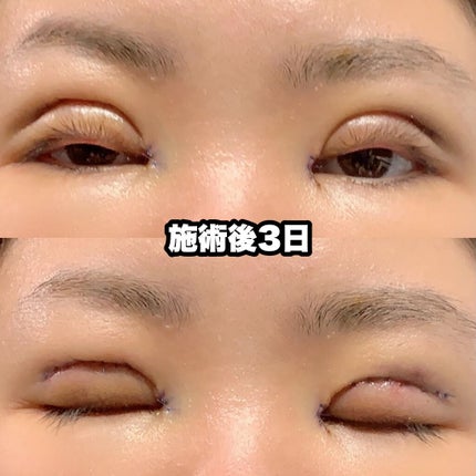 ïŸïœïœ³âžð·ïžâžâ on LIPS ãããã«ã¡ã¯ïŸïœïœ³ã§ãâžð·ïžâžâå
æ¥äºéæŽåœ¢ãããŸããïŒä»åã¯ç§..ãïŒ5æç®ïŒ