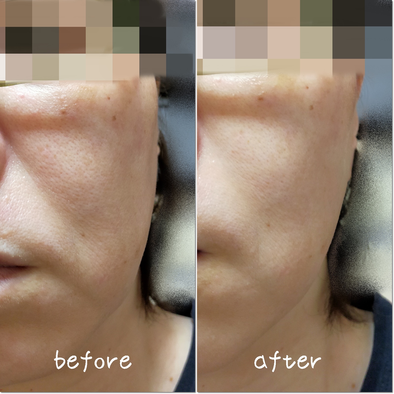 シカコラーゲンリフティングクリーム/be wants/フェイスクリームを使ったクチコミ（3枚目）