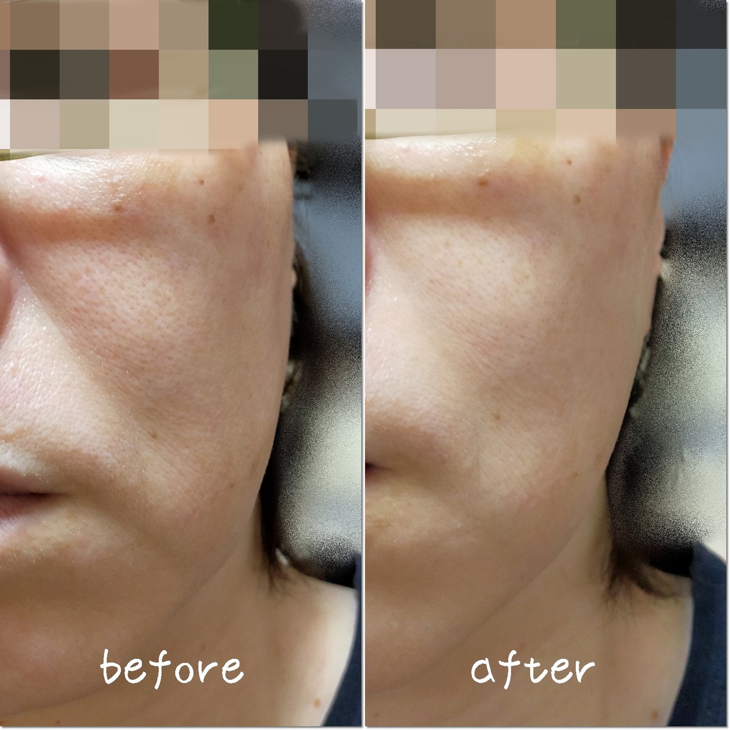 シカコラーゲンリフティングクリーム/be wants/フェイスクリームを使ったクチコミ(3枚目)