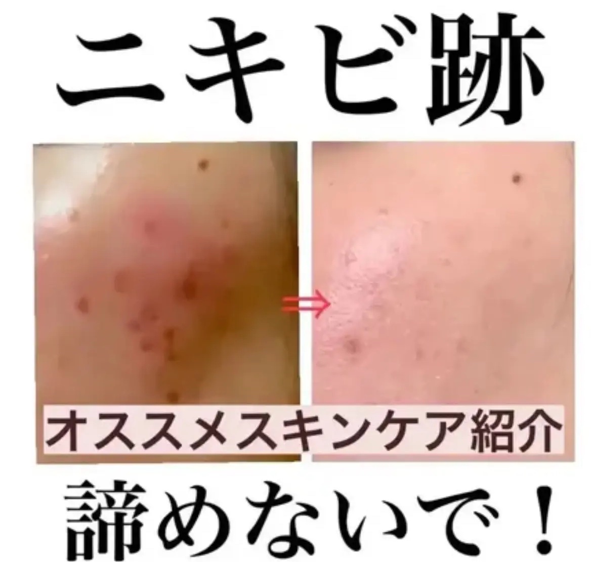 ホワイトニングクリアセラム/エトヴォス/美容液を使ったクチコミ（1枚目）