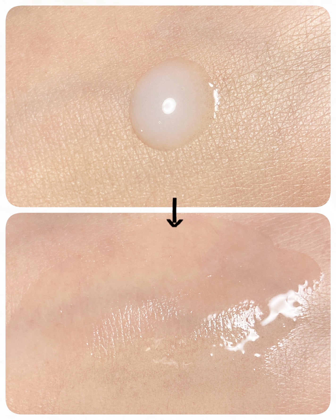 プラセホワイター 薬用美白エッセンスローション/プラセホワイター/化粧水を使ったクチコミ(3枚目)