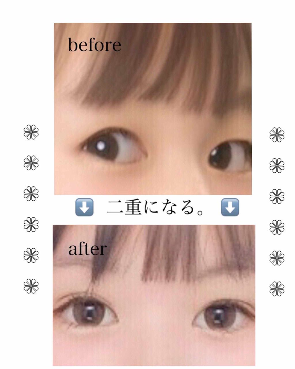 のびーるアイテープ（絆創膏タイプ、レギュラー）/DAISO/二重まぶた用アイテムを使ったクチコミ（1枚目）