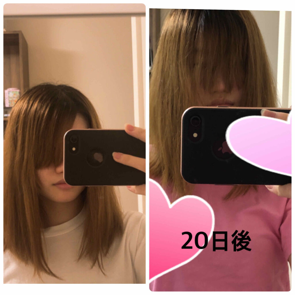 亜鉛 30日分 栄養機能食品 亜鉛 Dhcを使った口コミ だいぶ前にヘアアクセルレーターでどれだけ髪 By さやえんどう 脂性肌 代前半 Lips