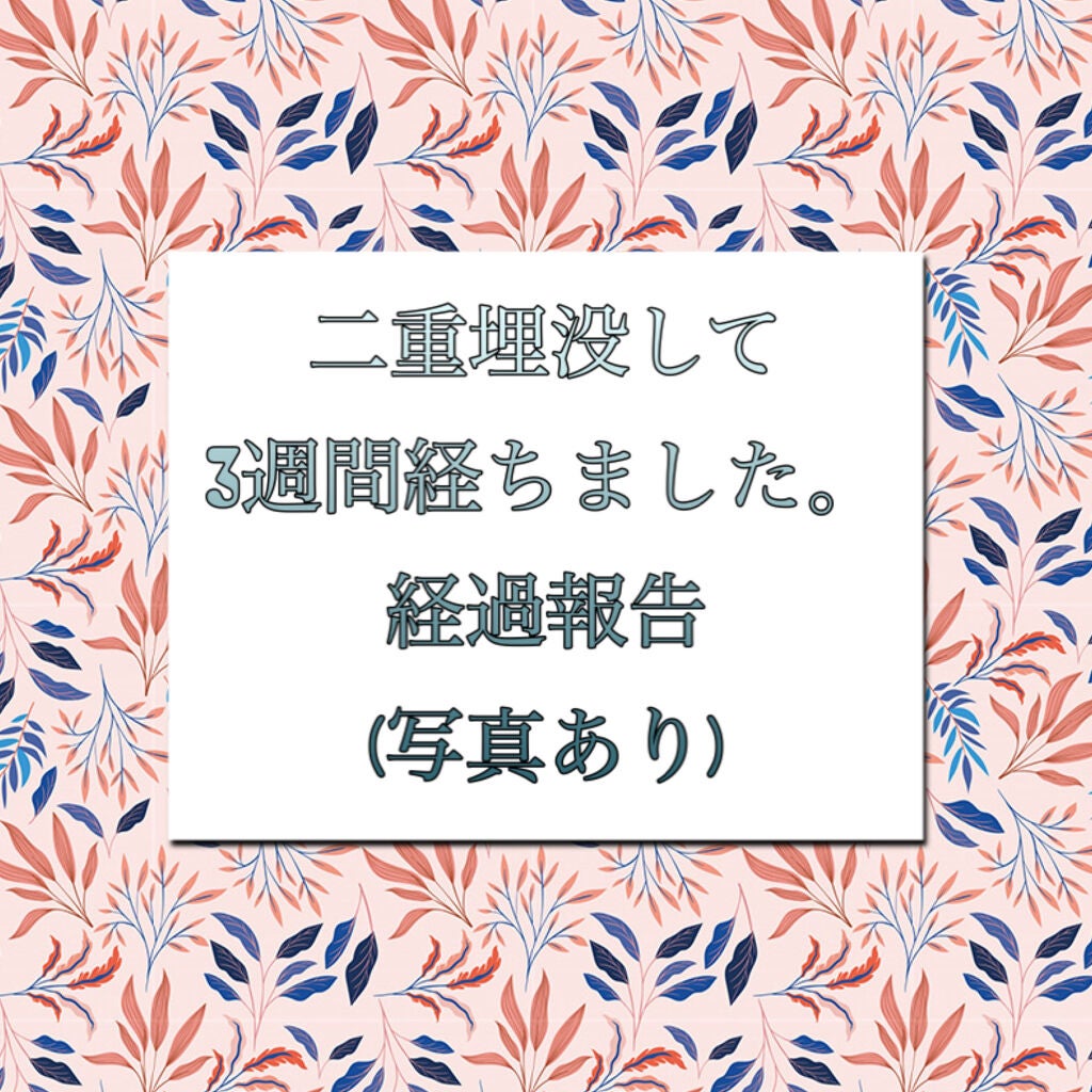yu___n@フォロバします🌸 on LIPS 「二重埋没して3週間経ちました!1週間までのレポは別投稿にあるの..」(1枚目)