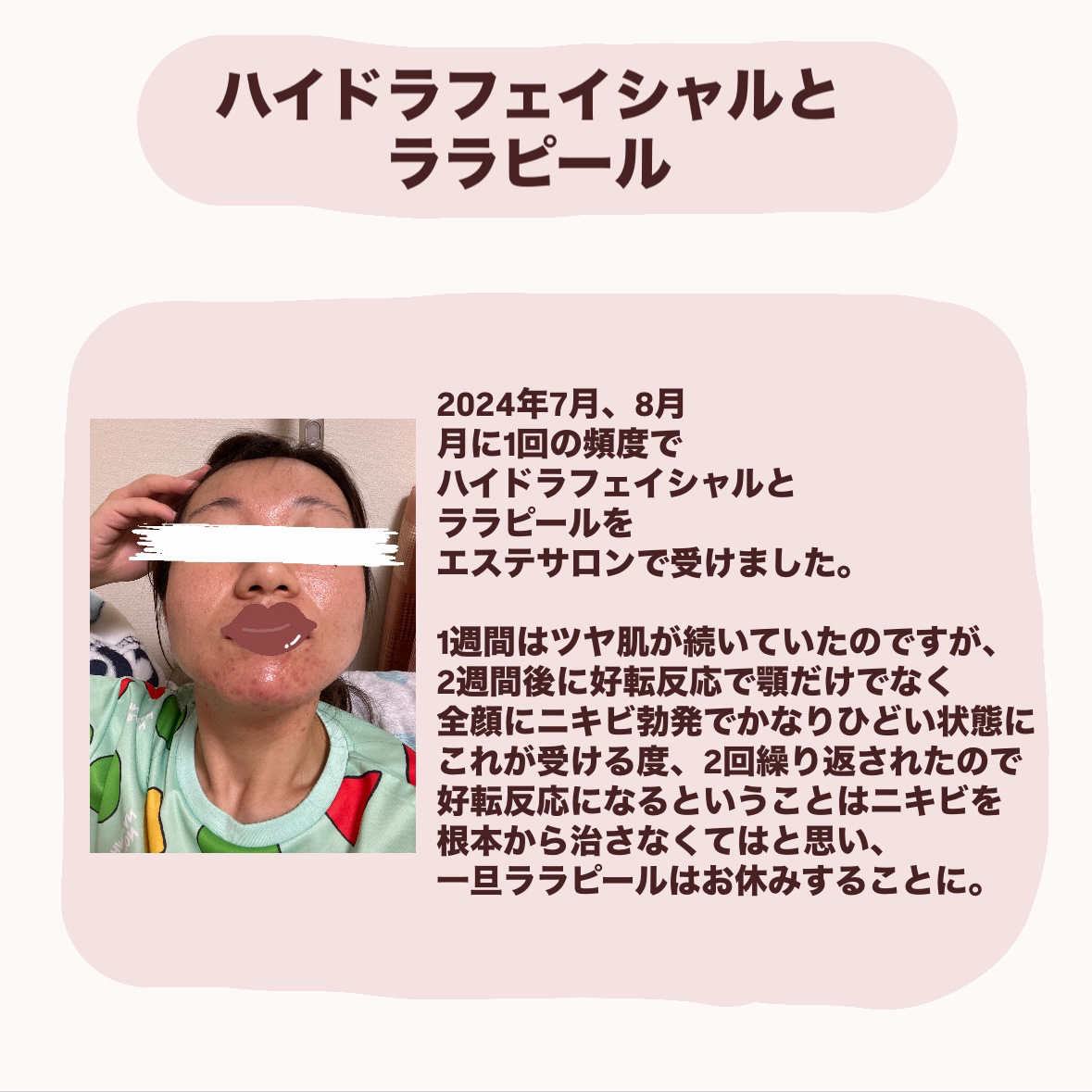 を使ったクチコミ（2枚目）