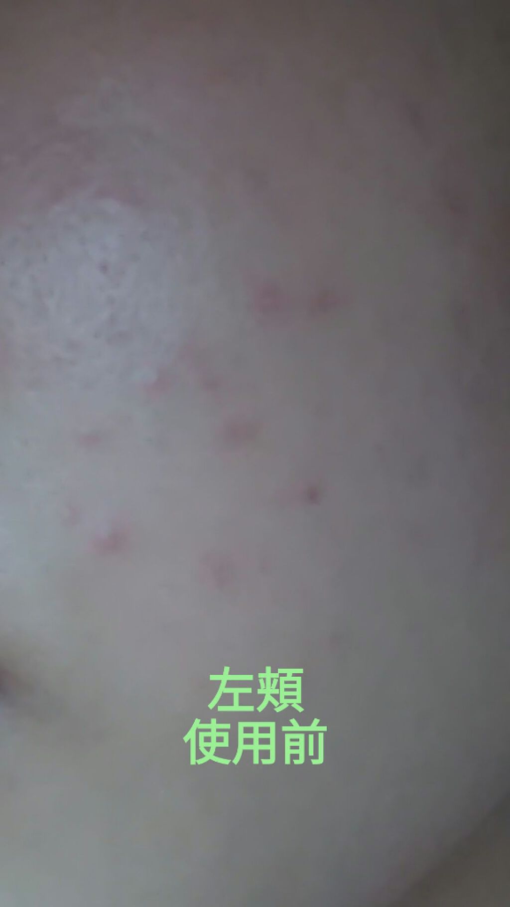 ティーツリーケアソリューション アンプルマスクJEX/MEDIHEAL/シートマスク・パックを使ったクチコミ（2枚目）