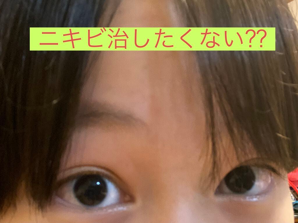 薬用アクネコントロール フレッシュ ローション/DHC/化粧水を使ったクチコミ(1枚目)