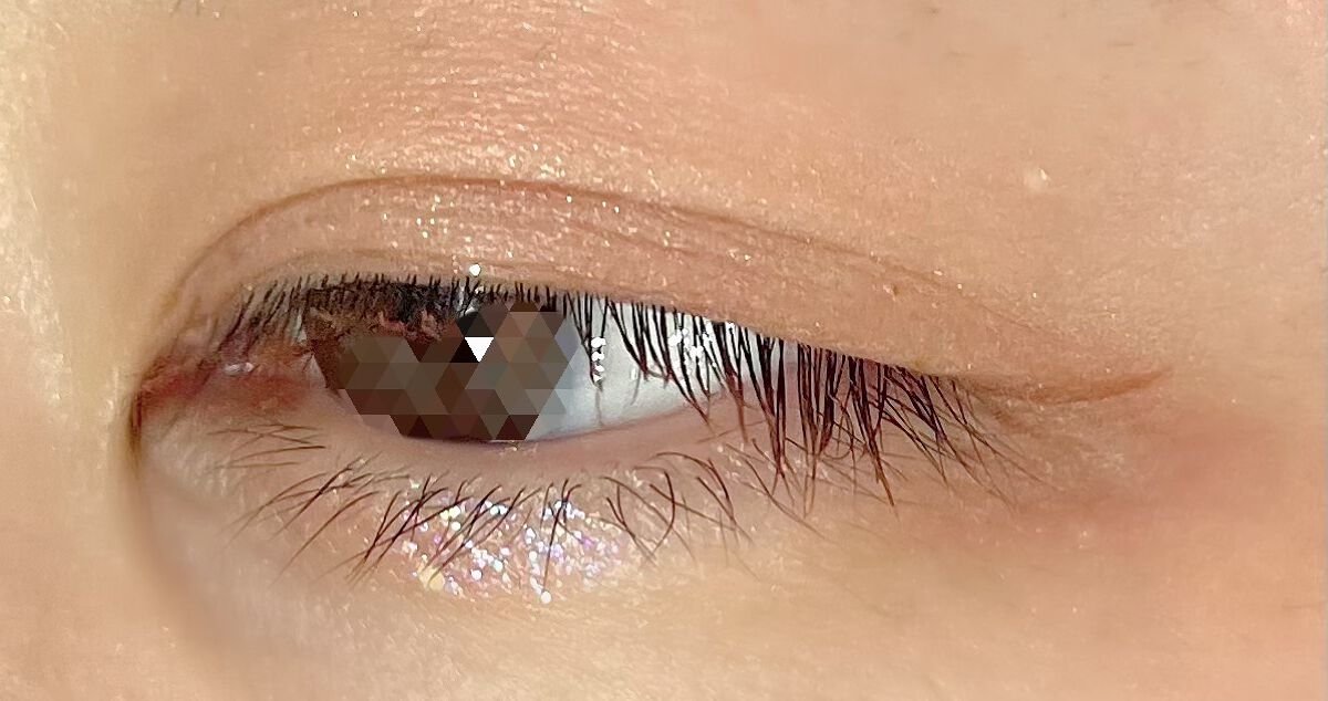 ãå¯çã¢ã€ã©ã€ããŒãã·ã§ãŒãçãªããã/ããžã£ãŽã¥/ãªãããã¢ã€ã©ã€ããŒã䜿ã£ãã¯ãã³ãïŒ5æç®ïŒ