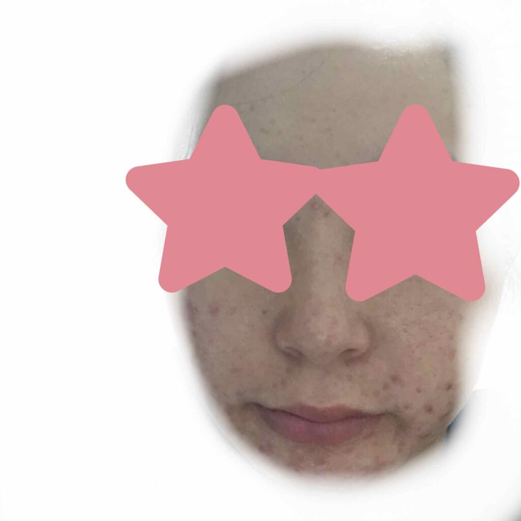 フェイスクレイウォッシュ/クレイビューティ/洗顔フォームを使ったクチコミ(2枚目)