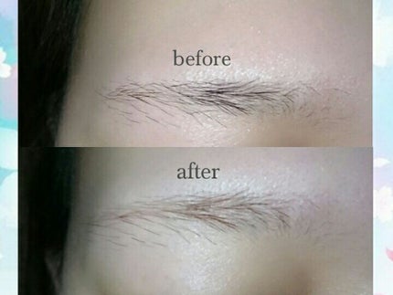 脱色クリーム スピーディー/エピラット/ムダ毛ケアを使ったクチコミ(3枚目)