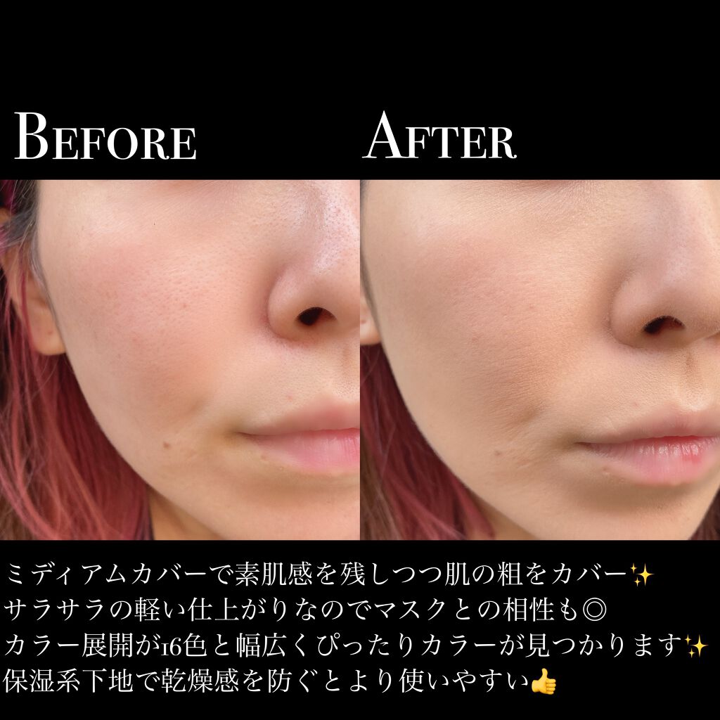 フィットミー コンシーラー/MAYBELLINE NEW YORK/リキッドコンシーラーを使ったクチコミ（3枚目）