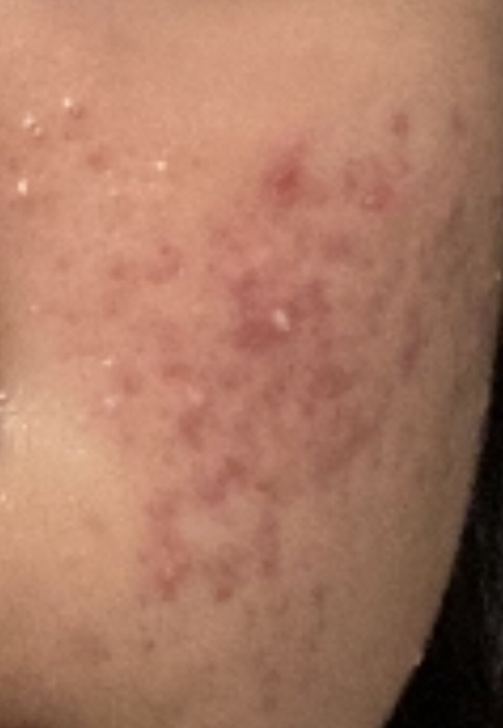 お米のパック/毛穴撫子/洗い流すパック・マスクを使ったクチコミ（2枚目）