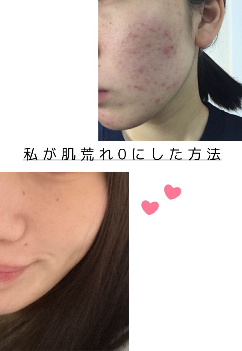 なめらか本舗 乳液 NA/なめらか本舗/乳液を使ったクチコミ（1枚目）