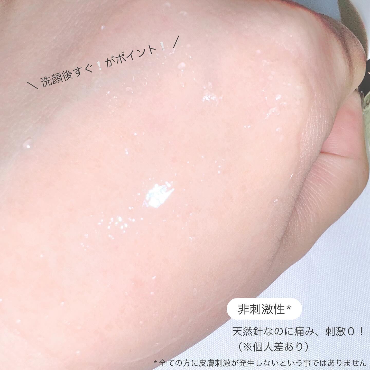 マイクロダーマブースター/XOUL/美容液を使ったクチコミ（3枚目）