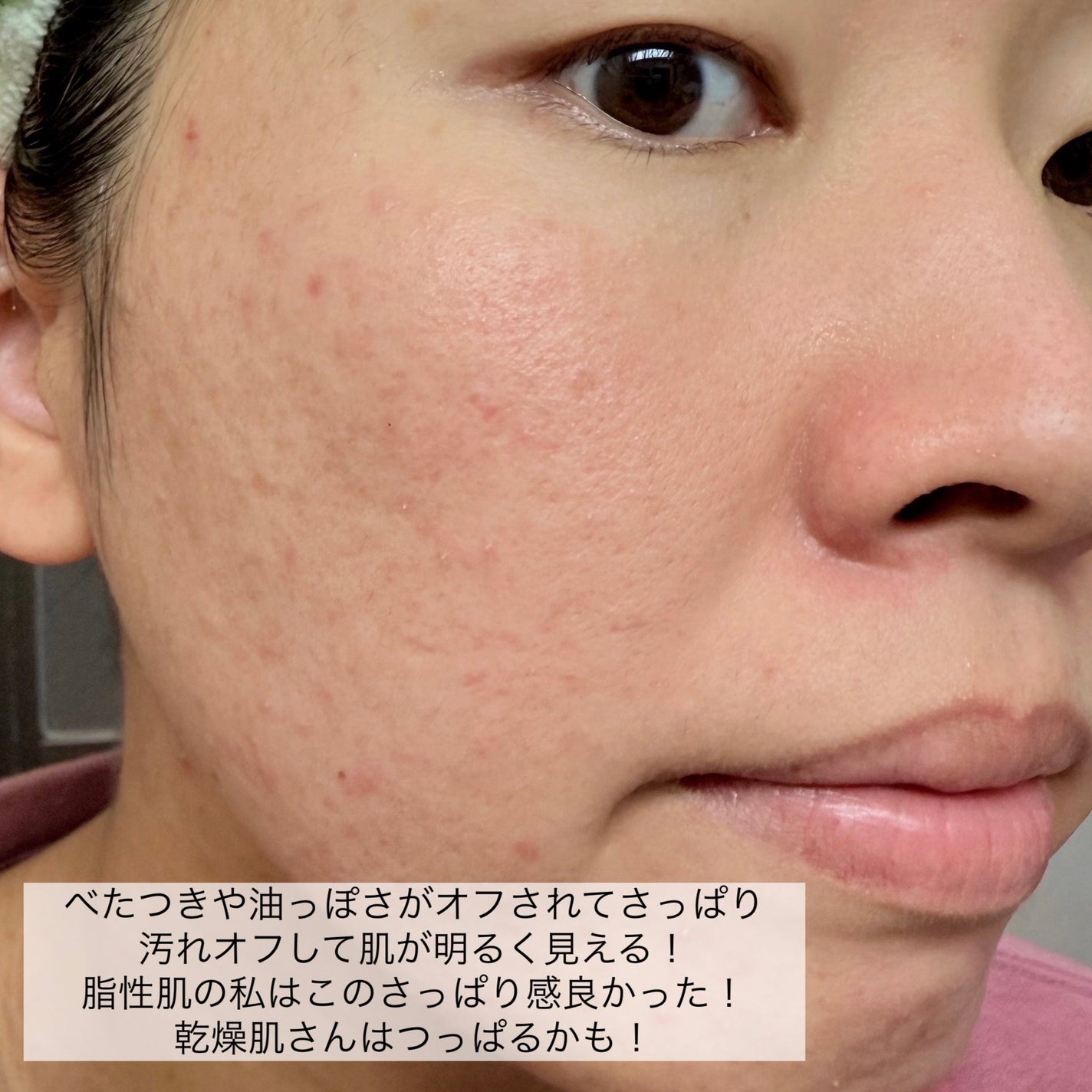 ACモイスト ウォッシュ パウダー/iniks/洗顔パウダーを使ったクチコミ(7枚目)