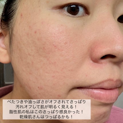 ACモイスト ウォッシュ パウダー/iniks/洗顔パウダーを使ったクチコミ(7枚目)