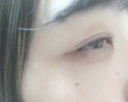 ディープビューラー/セリア/ビューラーを使ったクチコミ(3枚目)