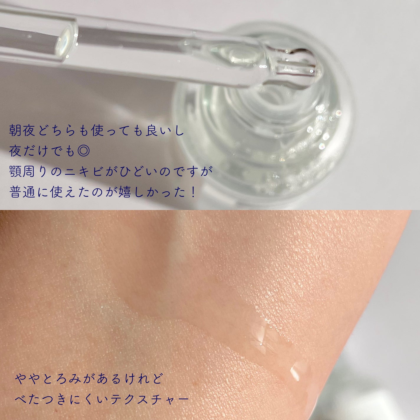 131 ポア クリアリング セラム/Celladix/美容液を使ったクチコミ(3枚目)