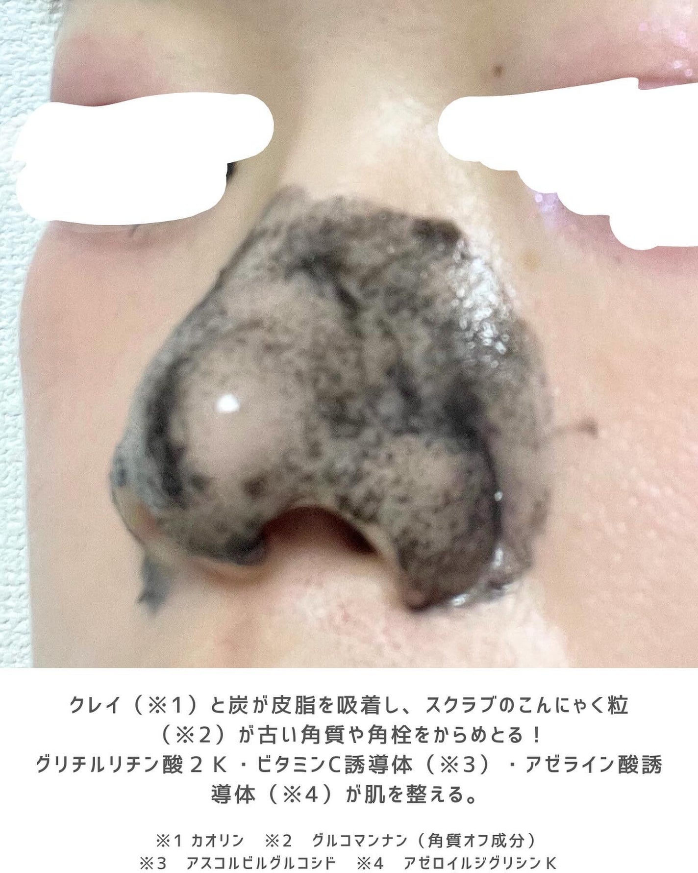 毛穴クエスト ポアクリアショットジェル AZ /エリザベス/その他洗顔料を使ったクチコミ(3枚目)