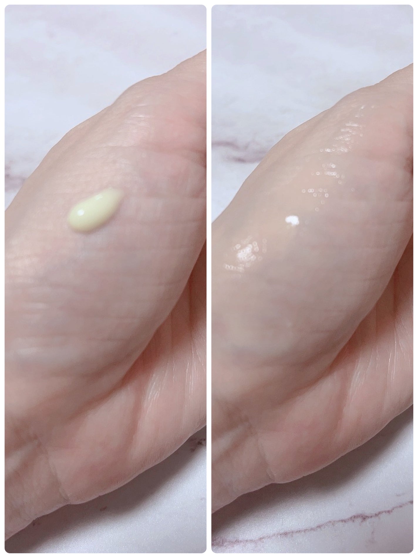 シカレチA エッセンス0.3/VT/美容液を使ったクチコミ(2枚目)