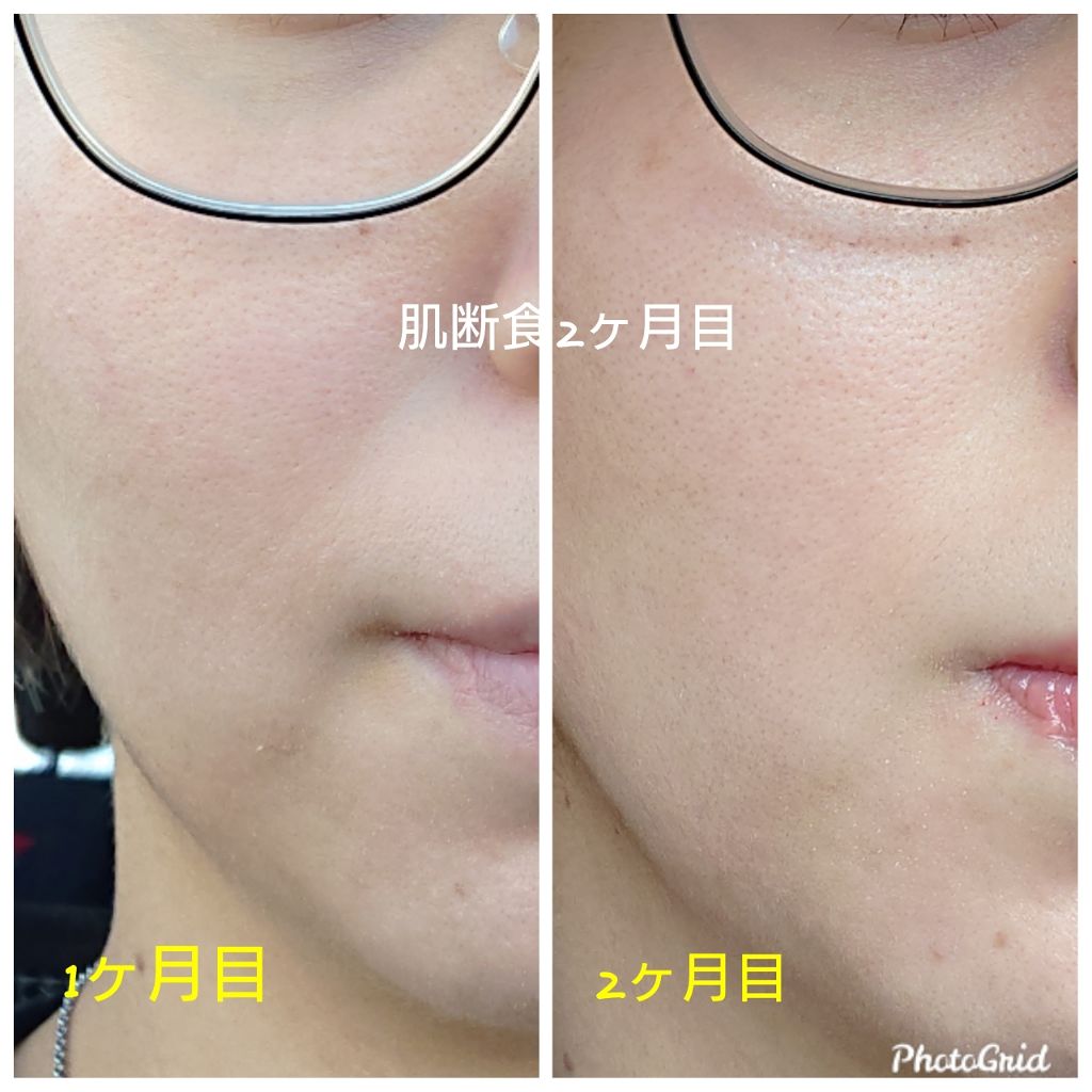 サンホワイトのボディクリーム サンホワイトp 1 サンホワイトシルキー Y 1を使った口コミ こんばんは お久しぶりの投稿です By Mari 敏感肌 代後半 Lips サンホワイトのボディクリーム サンホワイトp 1 サンホワイトシルキー Y 1を使った口コミ こんばんは お久しぶりの投稿です By Mari 敏感肌 代後半 Lips