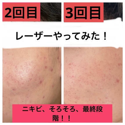 を使ったクチコミ(2枚目)