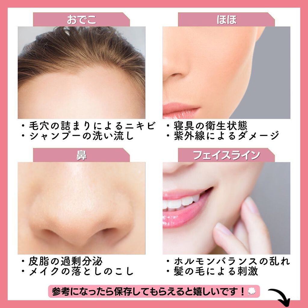 moiちゃん/メイク💄ファッション👗美容🌼 on LIPS 「@moi__life_←moiちゃんからの美容情報はこちら🤍本..」(8枚目)