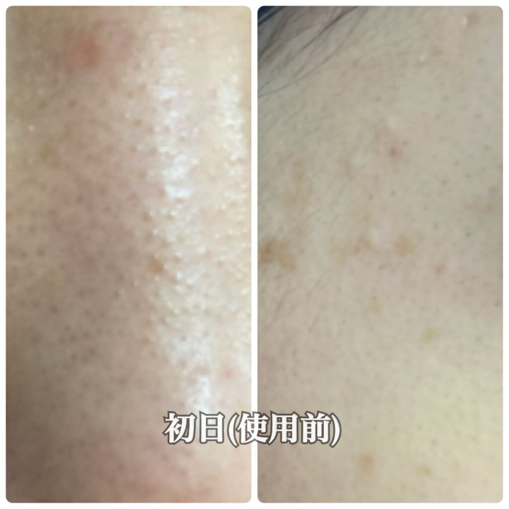 明色スキンコンディショナー/明色スキンコンディショニング/ブースター・導入液を使ったクチコミ（3枚目）