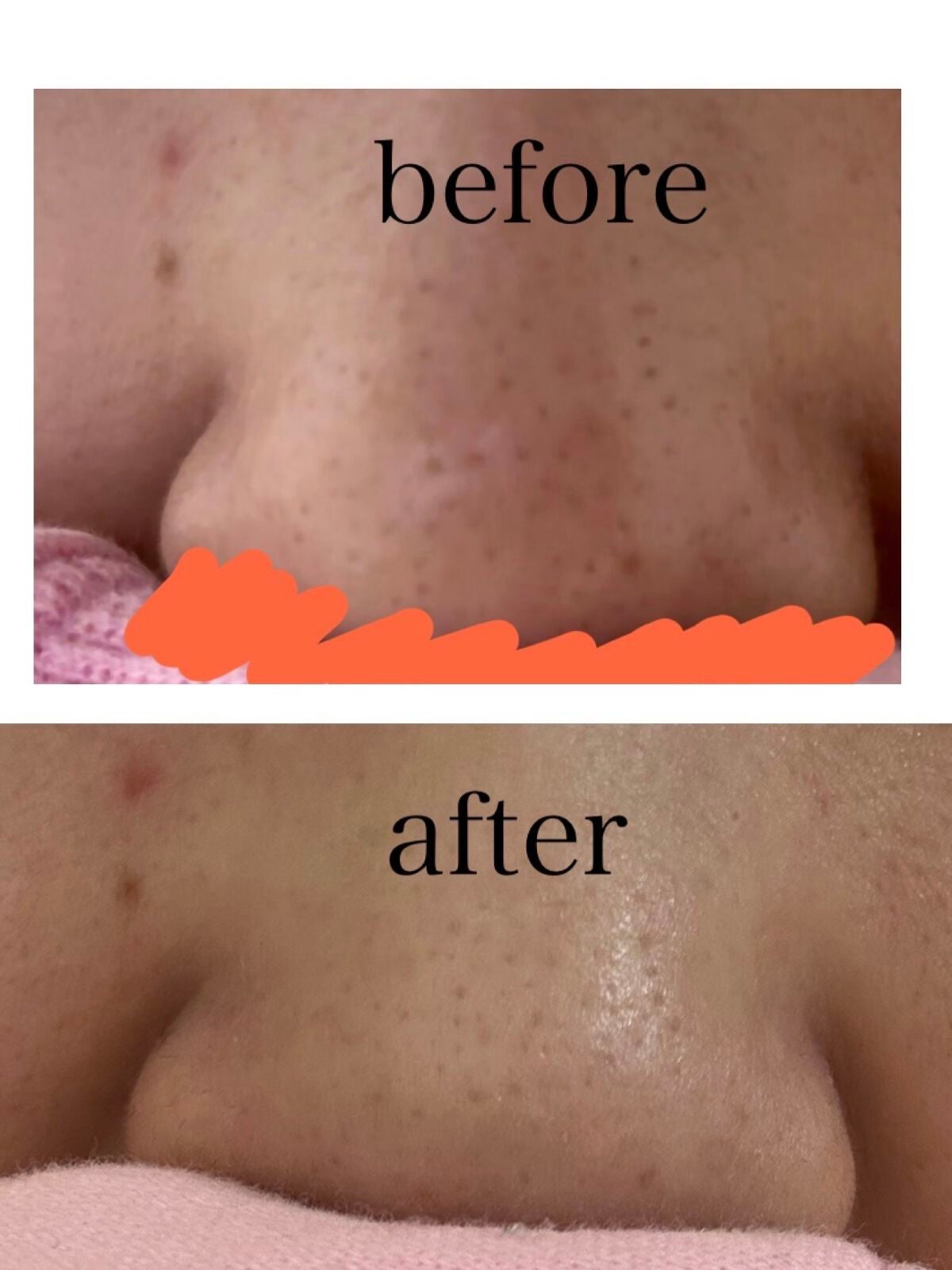 リフターナ 珪藻土パック/pdc/洗い流すパック・マスクを使ったクチコミ(3枚目)