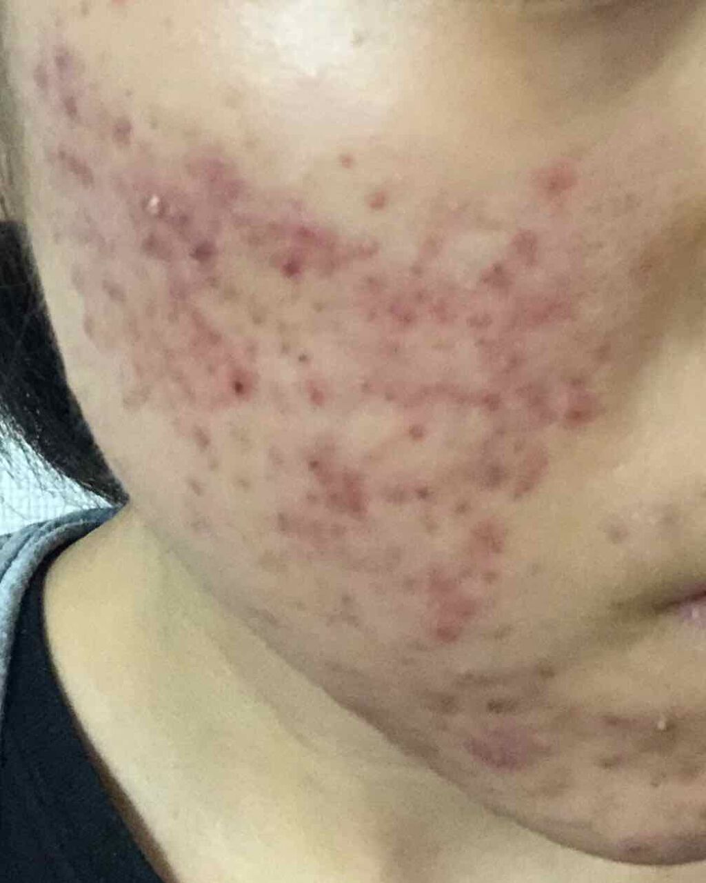 ãããð on LIPS ãã¯ãããŸããŠïŒãããðãšãããŸãïŒä»æ¥ããé¡é¢ãããçåŒŸãæ²»ã..ãïŒ2æç®ïŒ