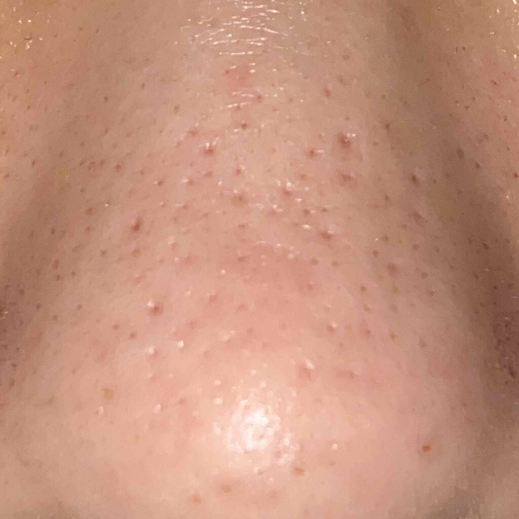 ミポキング on LIPS 「こんにちは!ポテトちゃんです!悩みです!!!!!!!この写真を..」(2枚目)