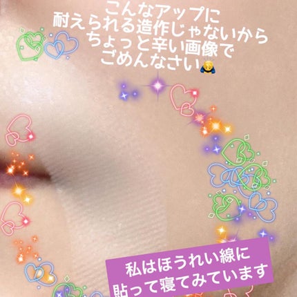 クリアターン ヒアロチューン マイクロパッチ 1500/クリアターン/シートマスク・パックを使ったクチコミ(4枚目)