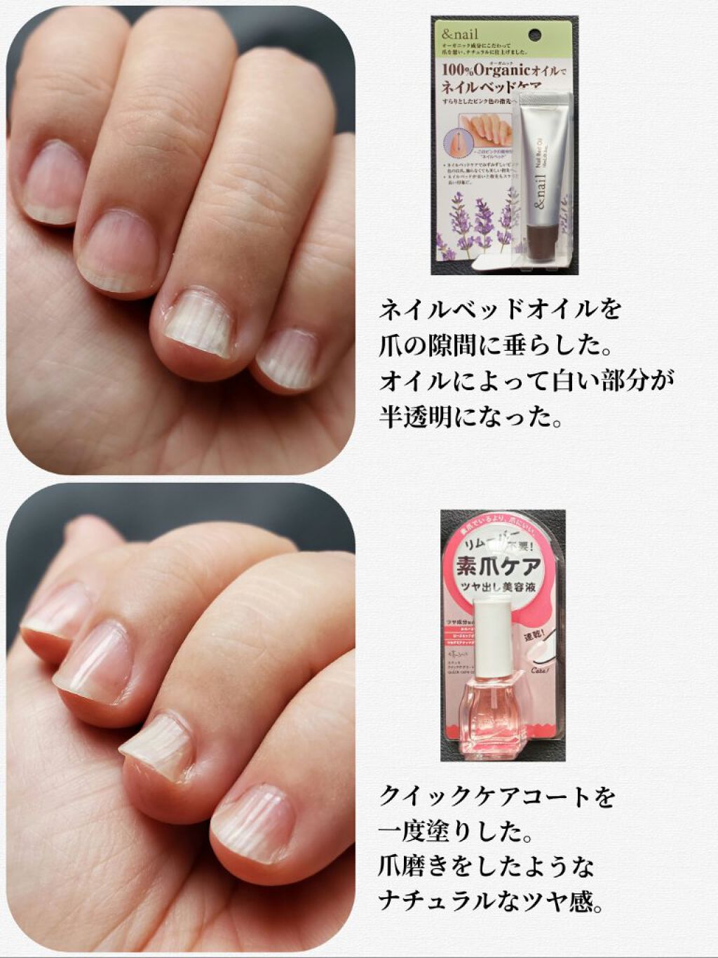 クイックケアコート Ettusaisを使った口コミ お見苦しい画像があります 重度の爪甲剥離 By かぴめろん 訪問率低下 深謝 乾燥肌 40代後半 Lips