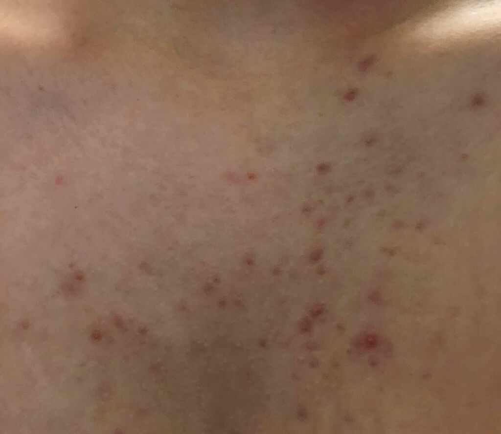 セナキュア(医薬品)/小林製薬/その他を使ったクチコミ（2枚目）