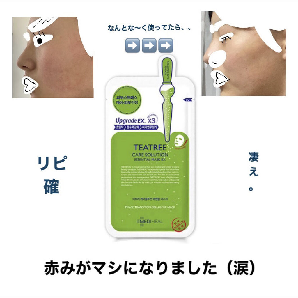 ティーツリーケア ソリューション エッセンシャルマスクEX/MEDIHEAL/シートマスク・パックを使ったクチコミ（1枚目）