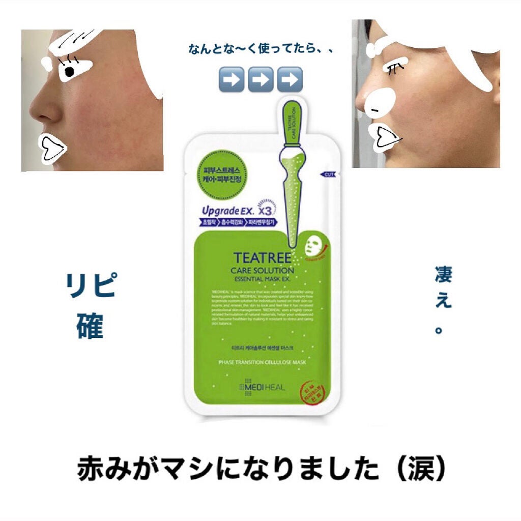 ティーツリーケア ソリューション エッセンシャルマスクEX/MEDIHEAL/シートマスク・パックを使ったクチコミ(1枚目)