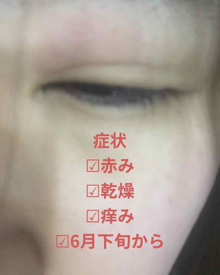 スキンケアセット(とてもしっとり)/IHADA/トライアルキットを使ったクチコミ(3枚目)