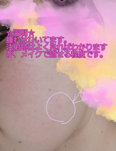 みずき on LIPS 「※スッピン写真なのでお肌汚いです！ご注意を！13日の金曜日にB..」（3枚目）