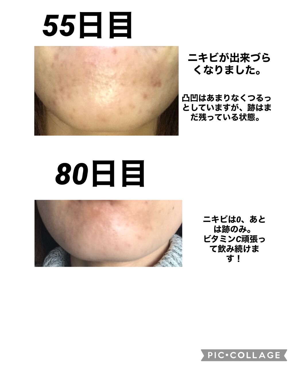 sky on LIPS 「今まで色々なスキンケアを試してきました。効果のあったものもあり..」(4枚目)