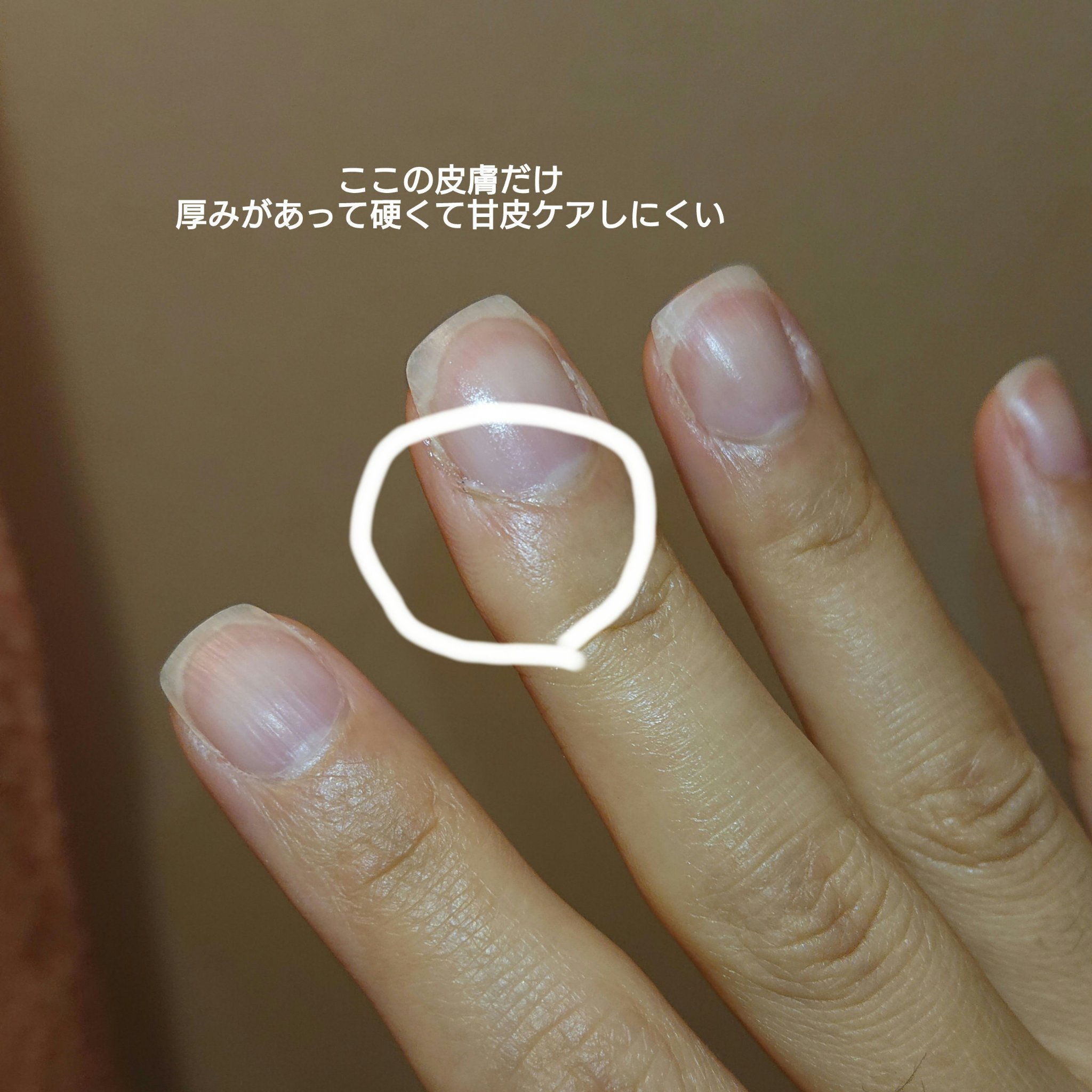 やわらか素肌クリームU (第3医薬品)/メンソレータム/その他を使ったクチコミ（3枚目）