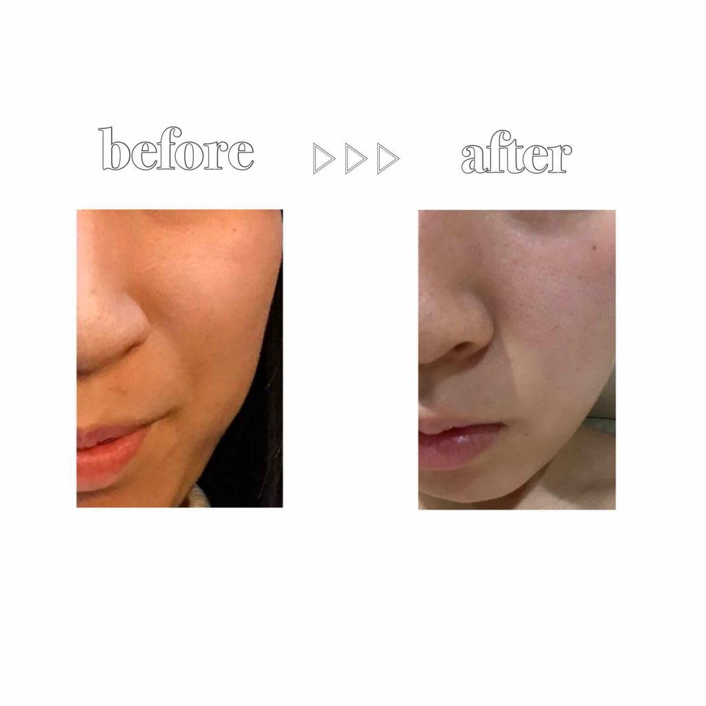 糀姫 おーるいんわんげる/シースタイル/オールインワン化粧品を使ったクチコミ(4枚目)