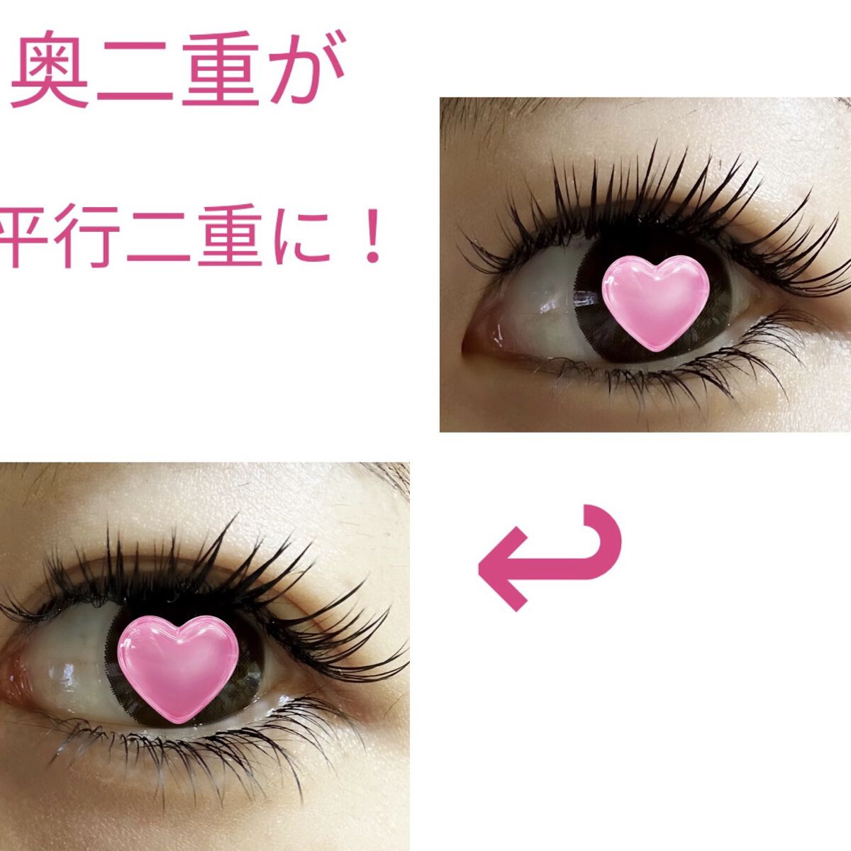 ナチュラルアイテープ/ビューティーワールド/二重まぶた用アイテムを使ったクチコミ（1枚目）