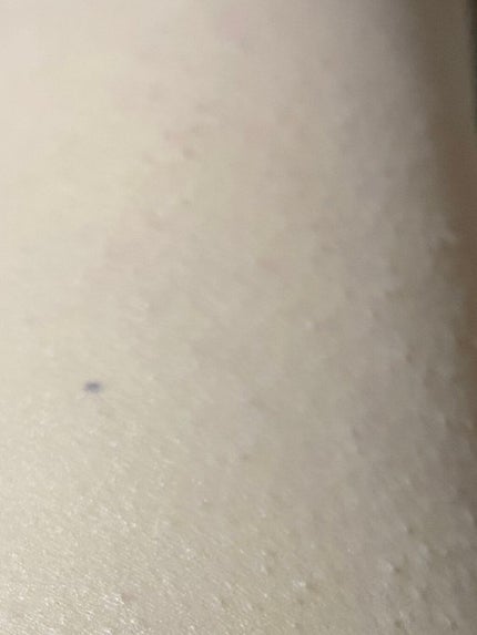 ドクタージャルト シカペア リカバー (第2世代)/Dr.Jart+/フェイスクリームを使ったクチコミ(5枚目)