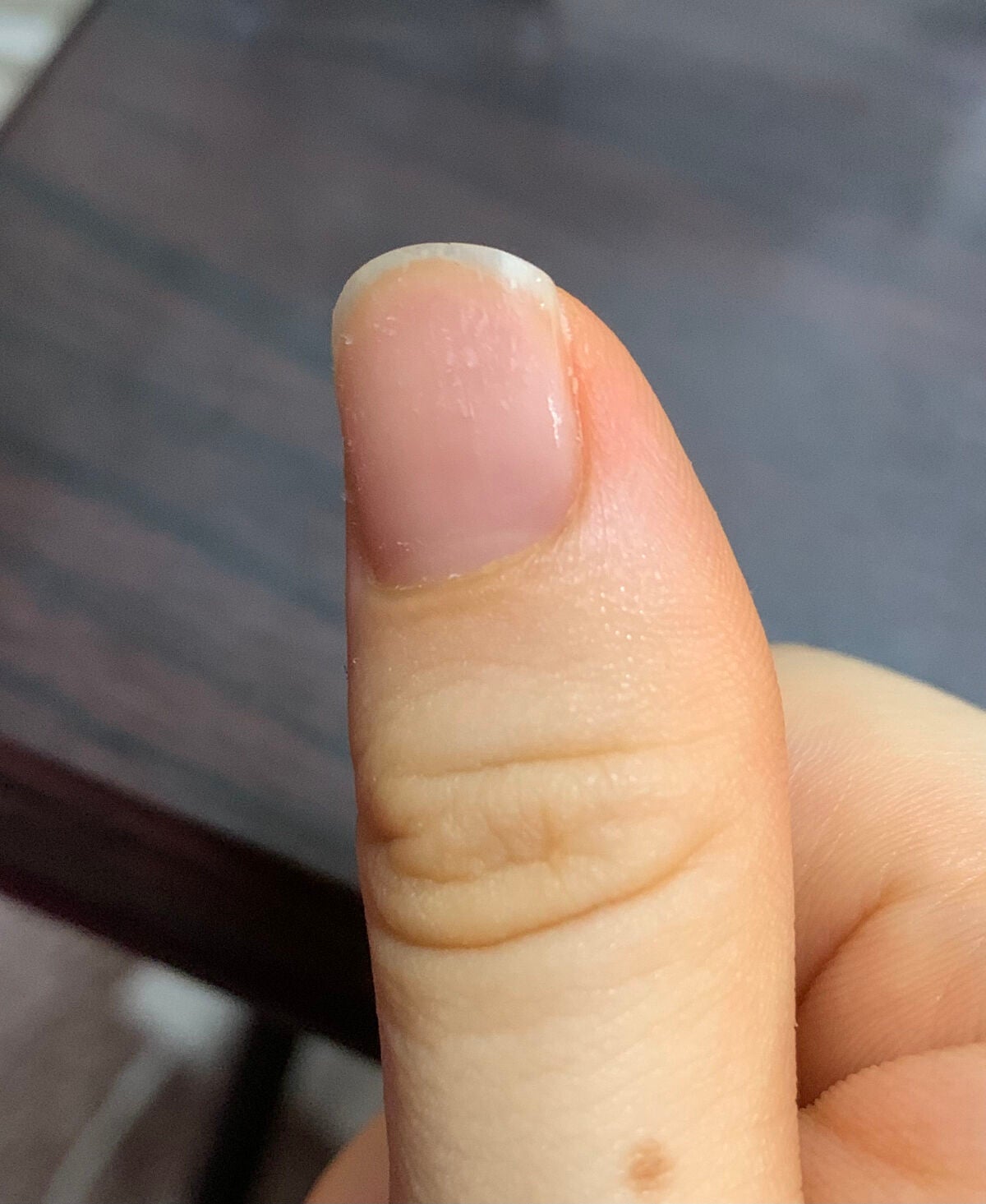 トリートメントネールリムーバー N/インテグレート/除光液を使ったクチコミ(1枚目)