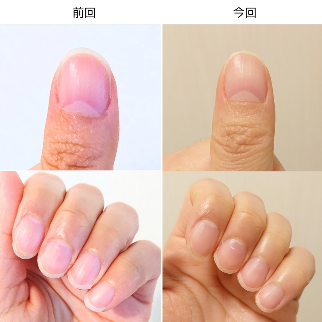 シア ネイルオイル 7.5ml【旧】/L'OCCITANE/ネイルオイル・トリートメントを使ったクチコミ（3枚目）